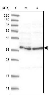 Western Blot: HEMK1 Antibody [NBP1-81019]