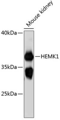 Western Blot: HEMK1 AntibodyAzide and BSA Free [NBP3-04688]