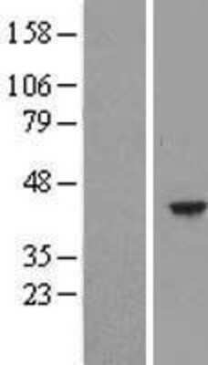 Western Blot: HEMK1 Overexpression Lysate [NBL1-11505]