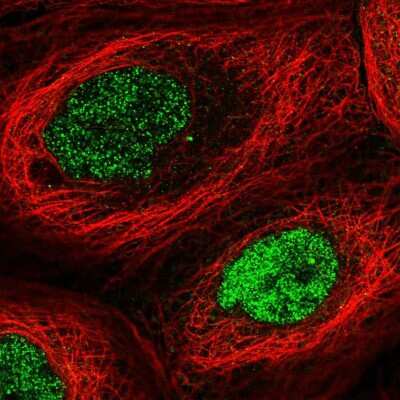 Immunocytochemistry/ Immunofluorescence: HEMK2 Antibody [NBP2-57126]