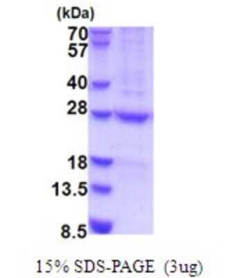 SDS-PAGE: Recombinant Human HEMK2 His Protein [NBP2-51881]