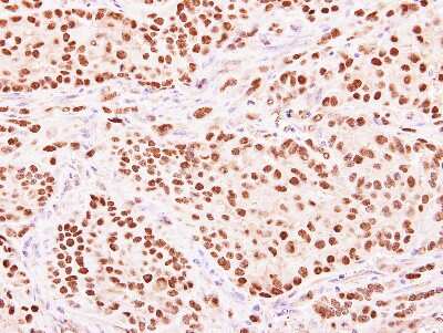 Immunohistochemistry-Paraffin: HENMT1 Antibody [NBP1-32620]
