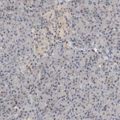 Immunohistochemistry-Paraffin: HENMT1 Antibody [NBP1-88330]