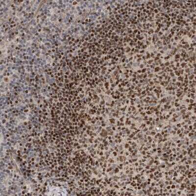 Immunohistochemistry-Paraffin: HENMT1 Antibody [NBP1-88330]