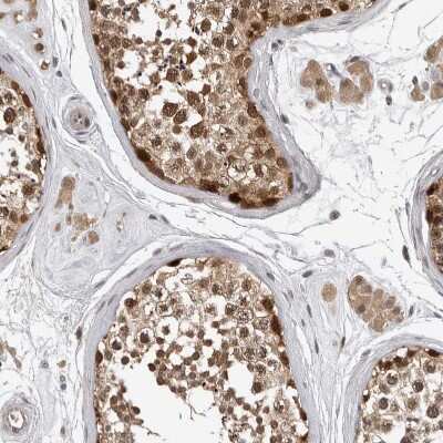 Immunohistochemistry-Paraffin: HENMT1 Antibody [NBP1-88330]