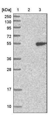 Western Blot: HENMT1 Antibody [NBP1-88328]