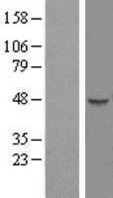 Western Blot: HENMT1 Overexpression Lysate [NBP2-09347]