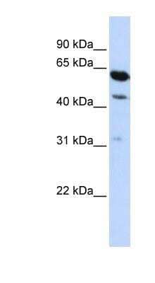 Western Blot: HEPACAM2 Antibody [NBP1-91588]