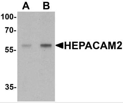 Western Blot: HEPACAM2 AntibodyBSA Free [NBP2-81720]