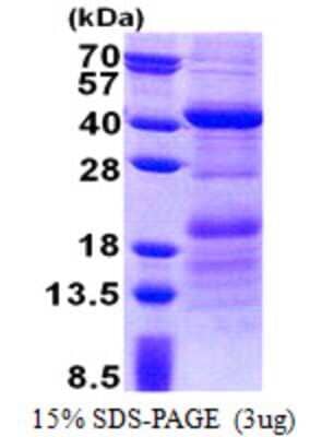 SDS-PAGE: Recombinant Human HEPACAM2 His Protein [NBP2-23115]