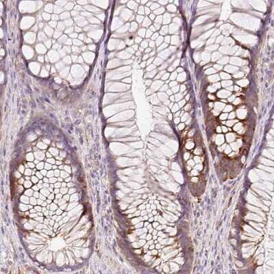 Immunohistochemistry-Paraffin: HERC2 Antibody [NBP2-37922]