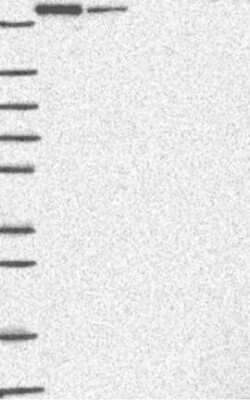 Western Blot: HERC2 Antibody [NBP3-17380]