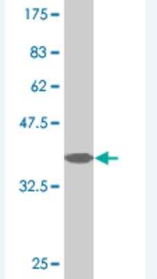 Western Blot: HERC3 Antibody (3G7) [H00008916-M02]