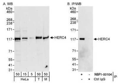 Western Blot: HERC4 Antibody [NBP1-00104]