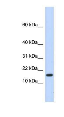 Western Blot: HERC4 Antibody [NBP1-53020]