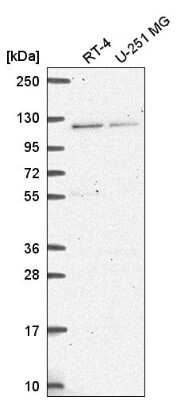 Western Blot: HERC4 Antibody [NBP2-56037]