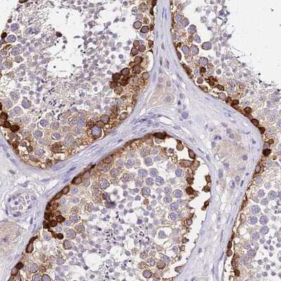 Immunohistochemistry-Paraffin: HERC5 Antibody [NBP1-91985]