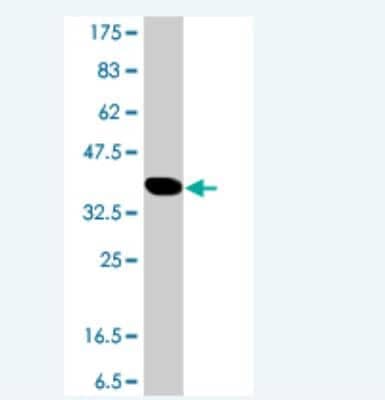 Western Blot: HERC5 Antibody [H00051191-A01]