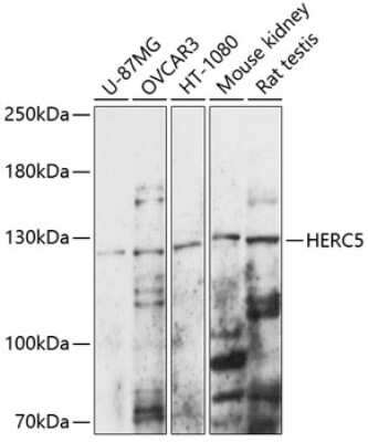 Western Blot: HERC5 AntibodyAzide and BSA Free [NBP3-04987]