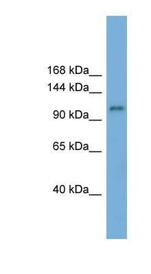 Western Blot: HERC6 Antibody [NBP1-55025]