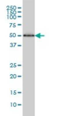 Western Blot: HERPUD1 Antibody (2G7) [H00009709-M04]