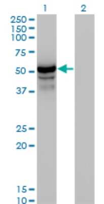 Western Blot: HERPUD1 Antibody (2G7) [H00009709-M04]