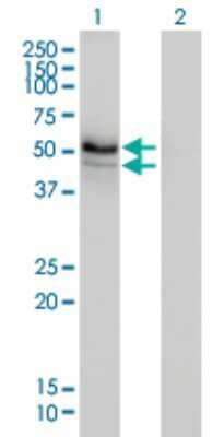 Western Blot: HERPUD1 Antibody (3E10) [H00009709-M01]