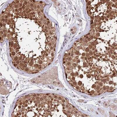 Immunohistochemistry-Paraffin: HERPUD1 Antibody [NBP1-83268]