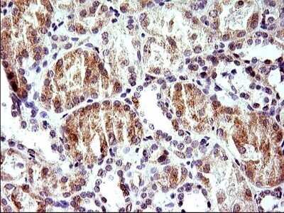 Immunohistochemistry: HERPUD1 Antibody (OTI1A2) - Azide and BSA Free [NBP2-71492]