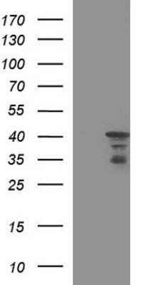 Western Blot: HERPUD1 Antibody (OTI1A2)Azide and BSA Free [NBP2-71492]