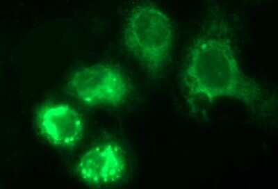 Immunocytochemistry/ Immunofluorescence: HERPUD1 Antibody (OTI1A2) [NBP2-45970]