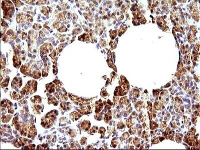 Immunohistochemistry: HERPUD1 Antibody (OTI1A2) [NBP2-45970]