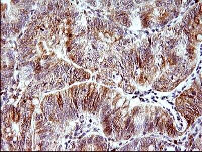 Immunohistochemistry: HERPUD1 Antibody (OTI1A2) [NBP2-45970]