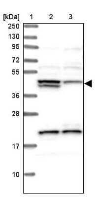 Western Blot: HERPUD1 Antibody [NBP1-83267]