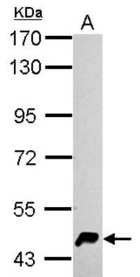 Western Blot: HERPUD1 Antibody [NBP2-16809]