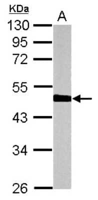 Western Blot: HERPUD1 Antibody [NBP2-16809]