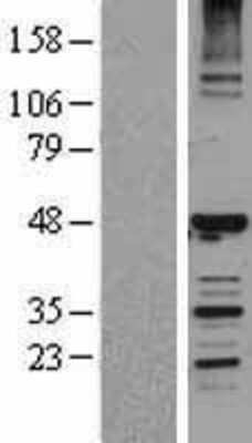 Western Blot: HERPUD1 Overexpression Lysate [NBL1-11508]