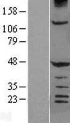 Western Blot: HERPUD1 Overexpression Lysate [NBL1-11509]