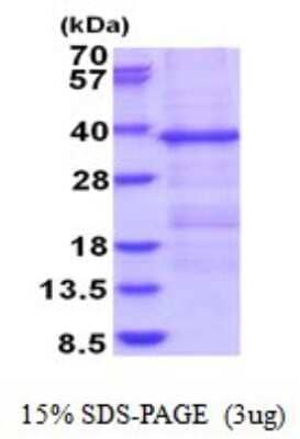 SDS-PAGE: Recombinant Human HERPUD1 His Protein [NBP2-51862]