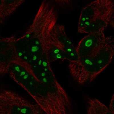 Immunocytochemistry/ Immunofluorescence: HERPUD2 Antibody [NBP2-55896]