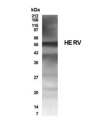 Western Blot: HERV AntibodyBSA Free [NB100-93579]