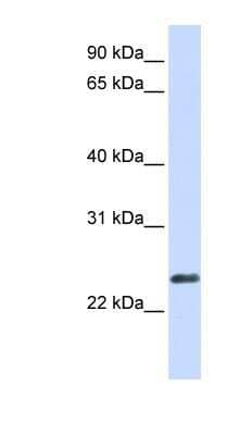 Western Blot: HERV Antibody [NBP1-60024]