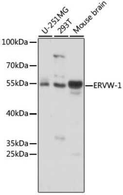 Western Blot: HERV AntibodyAzide and BSA Free [NBP3-02944]