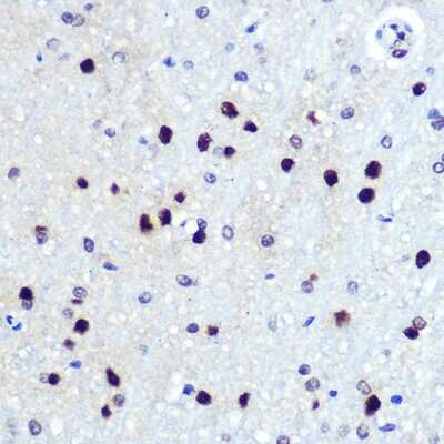 Immunohistochemistry-Paraffin: HES-1 Antibody (9I2E8) [NBP3-15320]