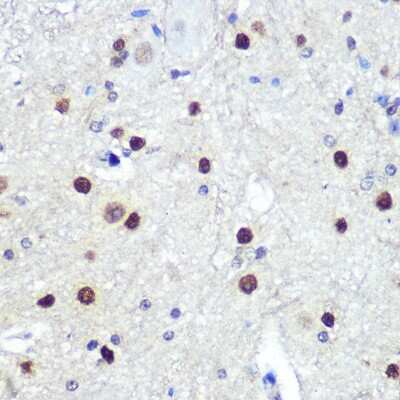 Immunohistochemistry-Paraffin: HES-1 Antibody (9I2E8) [NBP3-15320]