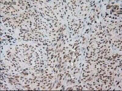 Immunohistochemistry: HES-1 Antibody (OTI4H1) - Azide and BSA Free [NBP2-70937]