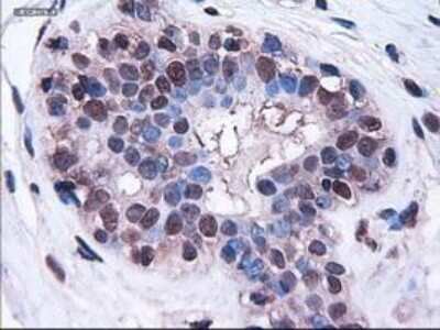 Immunohistochemistry-Paraffin: HES-1 Antibody (OTI4H1) [NBP1-47791]