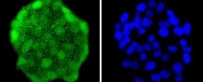 Immunocytochemistry/ Immunofluorescence: HES-1 Antibody (SC06-21) [NBP2-67642]