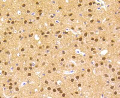 Immunohistochemistry-Paraffin: HES-1 Antibody (SC06-21) [NBP2-67642]