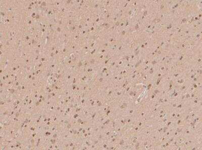 Immunohistochemistry-Paraffin: HES-1 Antibody (SC06-21) [NBP2-67642]
